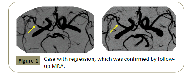 stroke-Case-regression